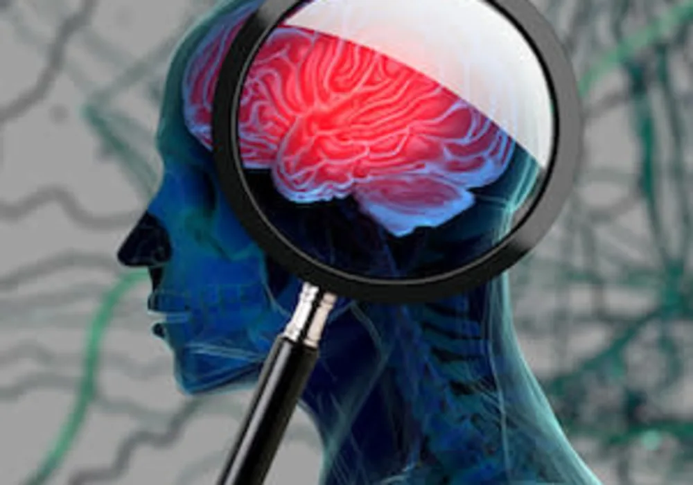 Cardiovascular Disease, Diabetes Increase Risk of Dementia 