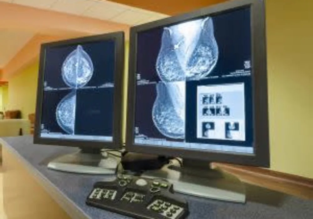 New Study Suggests Breast Cancer Patients Over 65 May Not Always Need Radiation Therapy 