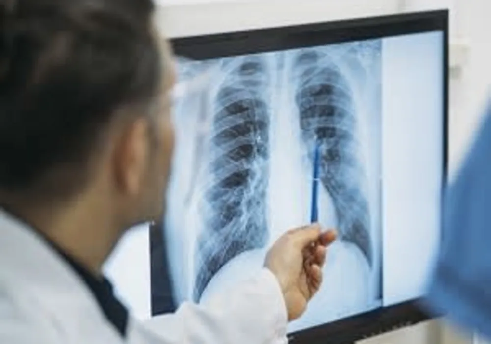 AI Accurately Identifies Normal and Abnormal Chest X-Rays