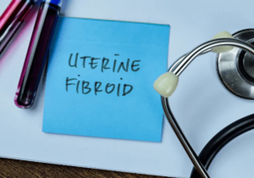 Ablation vs. Hysterectomy for Fibroids