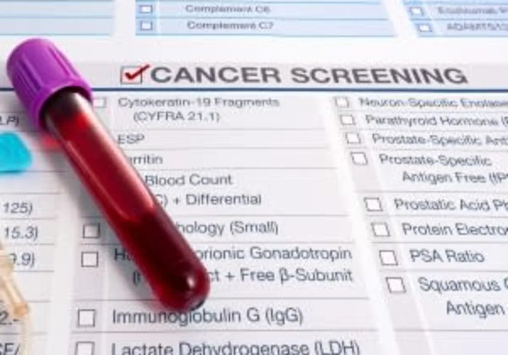 Study Suggests Cancer Screening Tests Might Not Prolong Lifespan