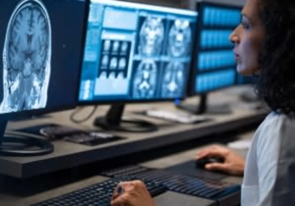 Revised MRI Guidelines Reduce Neuroradiologist Call Burden 