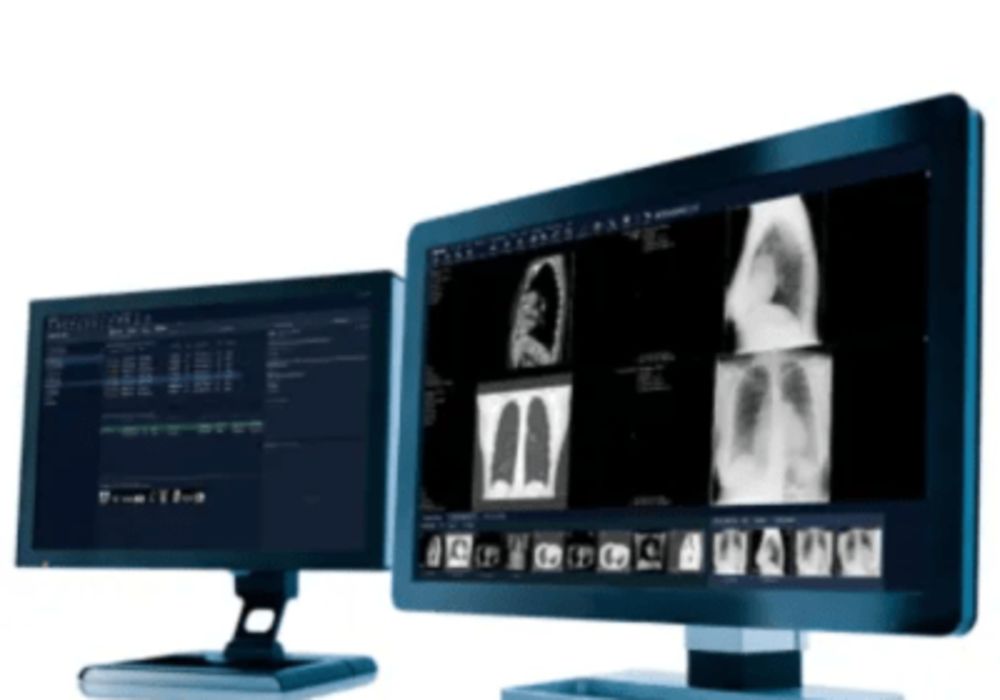 Netherland&#039;s Hospital Selects Sectra for Enterprise Imaging