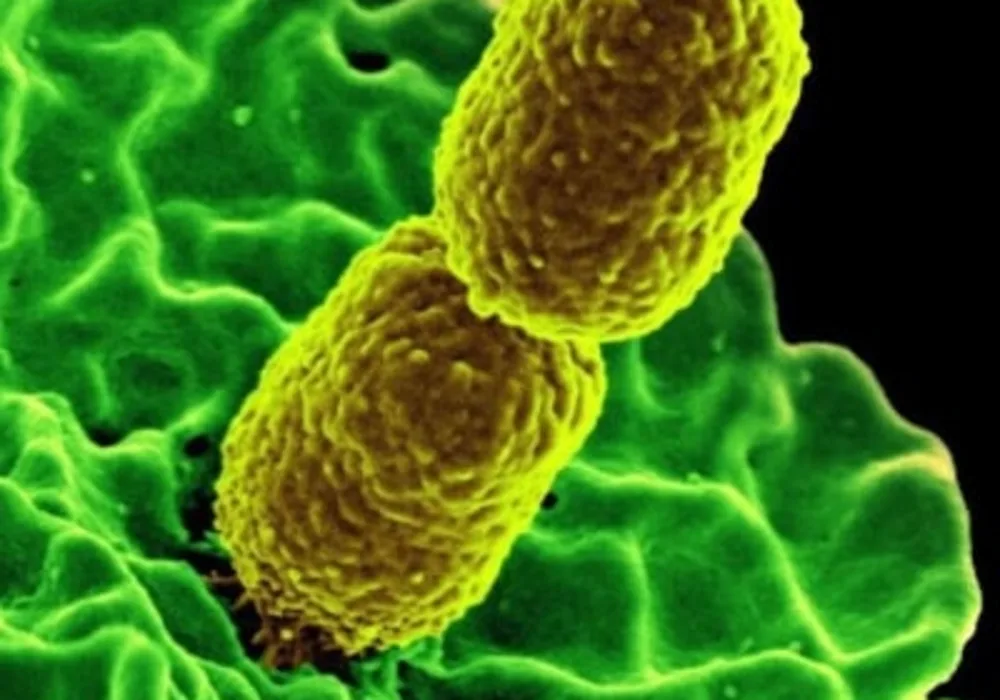 Rise of Hypervirulent Antibiotic-Resistant Bacteria in Europe