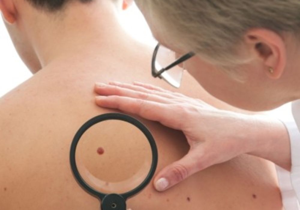 Lockdowns Linked to Skin Cancer Delays Costing &euro;7bn in Europe