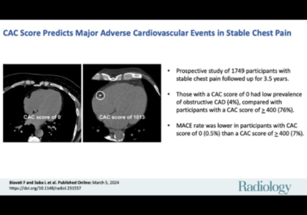 Coronary Artery Calcium Score Could be Predictor of Heart Attacks &amp; Strokes