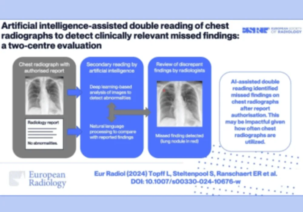 Enhancing Chest Radiograph Interpretation: Pioneering Study on AI-Assisted Double Reading Workflow