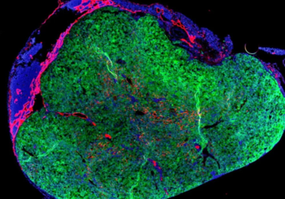 Innovation in Liver Failure Treatment: Growing a Mini Liver in Patients&rsquo; Lymph Node