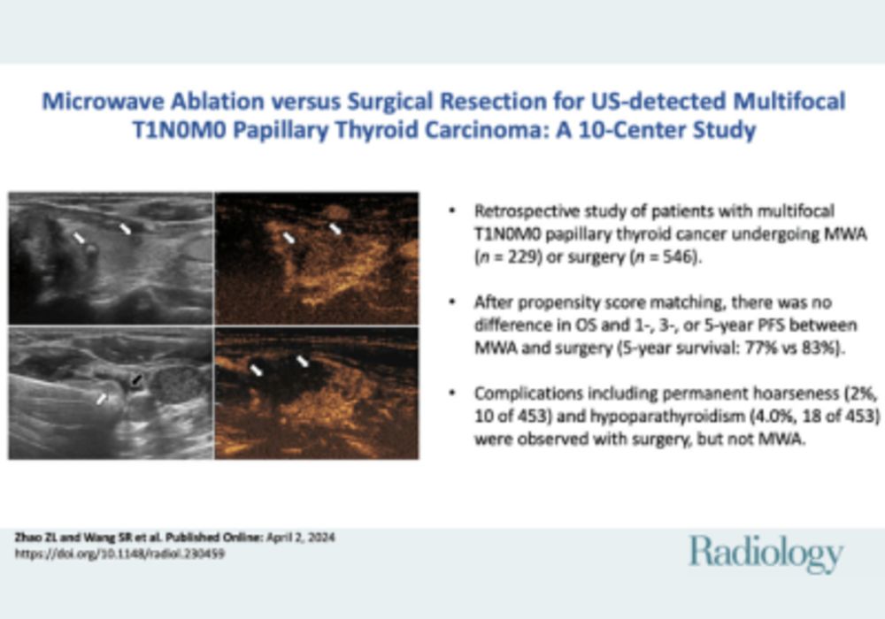 Microwave Ablation Offers New Treatment Options for Thyroid Cancer Patients