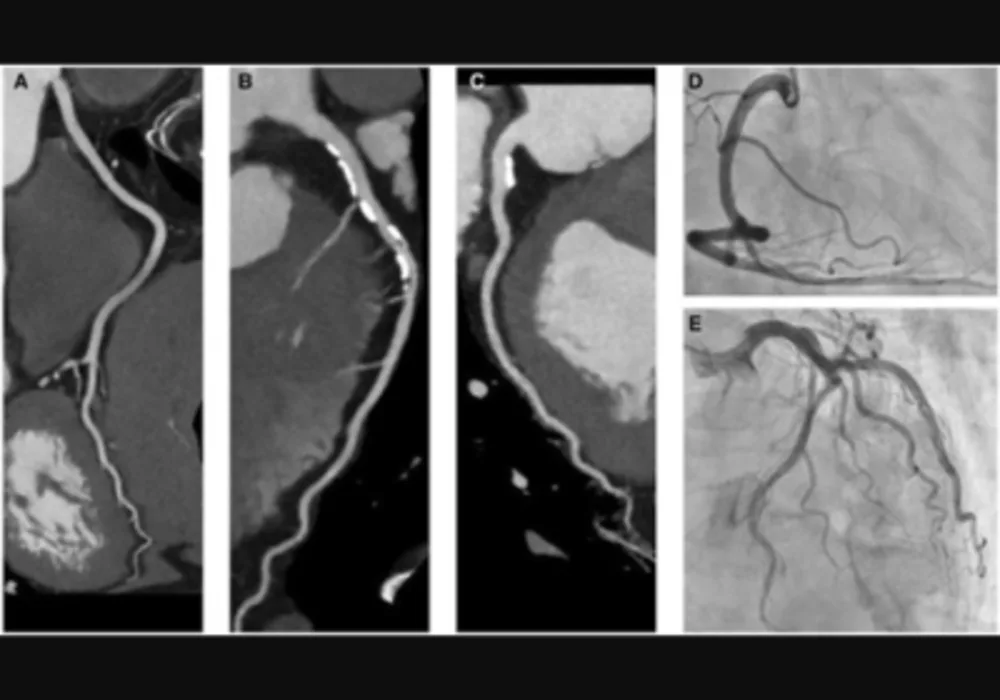 Deep Learning in CT Image Reconstruction: Enhancing Quality and Efficiency