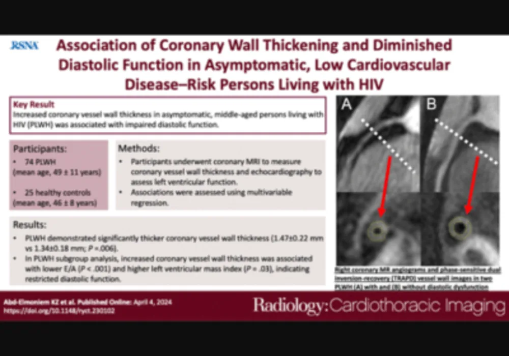 MRI Detection of Coronary Artery Pathology and Diastolic Dysfunction HIV+ patients