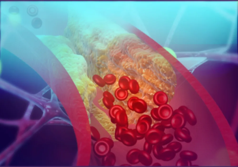 CT-FFR Analysis Lowers Invasive Procedures for Coronary Artery Disease Diagnosis