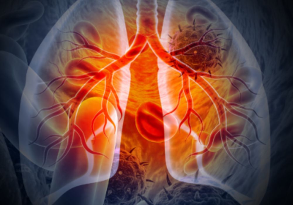 Impact of Patient Comorbidities on Shared Decision-Making Practices in Lung Cancer Screening