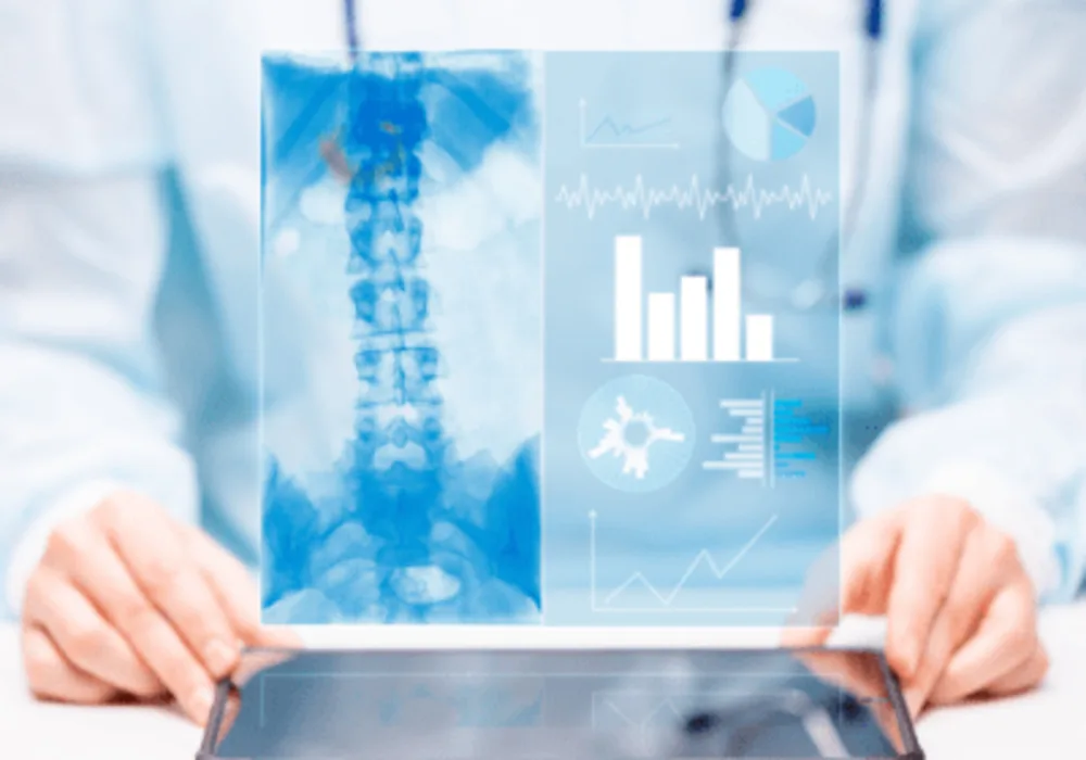 Using ChatGPT to Structure Data from Mechanical Thrombectomy Radiology Reports