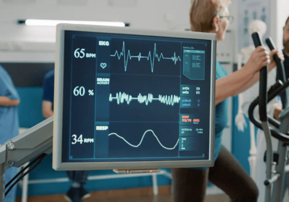 AI-Enabled ECG Reduces Mortality: Breakthrough in Medical AI