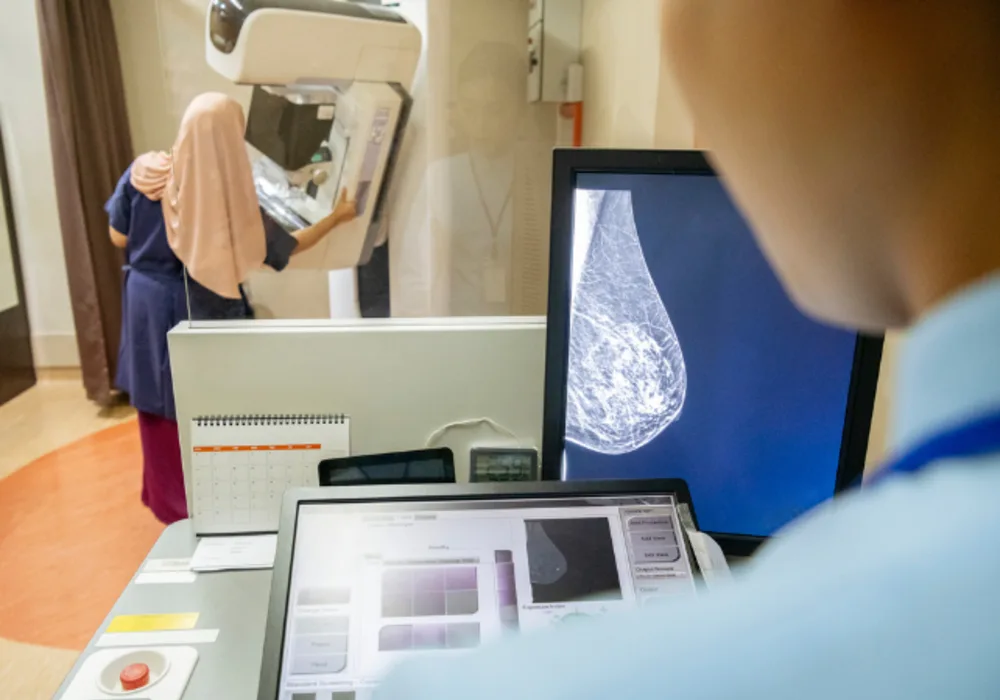 USPSTF Breast Cancer Screening Recommendations Shifts Towards Earlier Screening