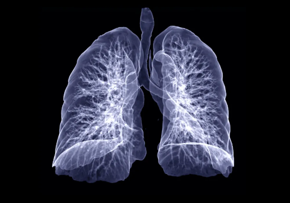 How to Better Manage Subsolid Lung Nodules?