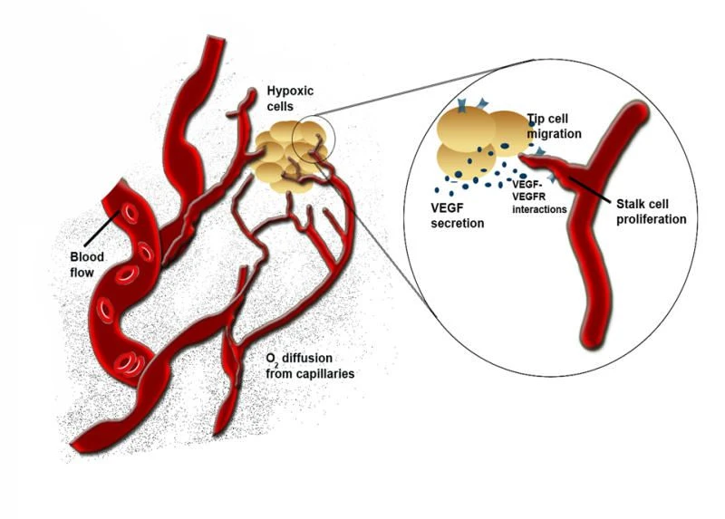 How Blood Vessels Regroup After Stroke