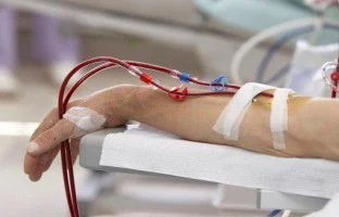 Frequent Dialysis Poses Risks for Kidney Disease Patients