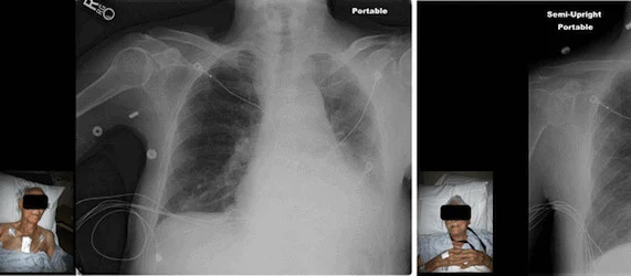 Integrating Patient Photos with Imaging Exams