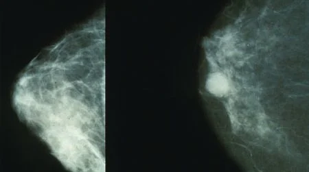 Test Set Mammography Data Can Reasonably Describe Actual Clinical Reporting 