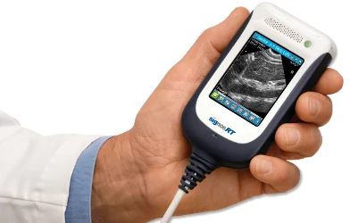 Signostics Handheld Ultrasound Device Cleared For America 