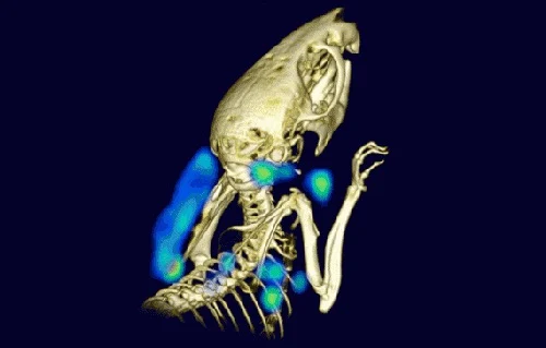 Noninvasive Imaging of Immune System Detects Tumours