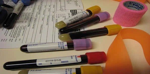 New Blood Test Rules Out Heart Attack 