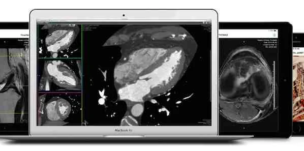 Calgary Scientific  Extends Web and Mobile Image Access: Partnership with Hyland 