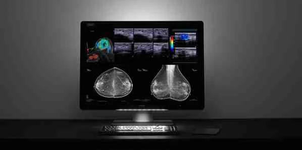 Barco Launches Breast Imaging and PACS Display  