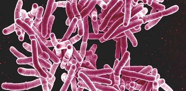 &#039;Genetic Barcode&#039; for Identifying TB Strains