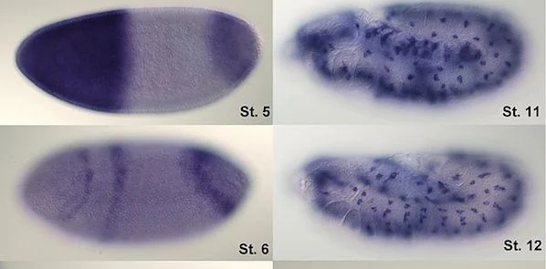 Radiogenomic Imaging Could Replace Biopsy