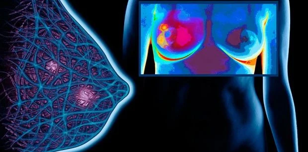 Innovative Breast Imaging Systems