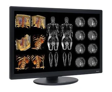 New Benchmark: Dome S6c LED Color Radiology Display Launched