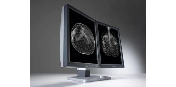 SIIM 2014: Barco Introduces New Image-Enhancing Diagnostic Display System 