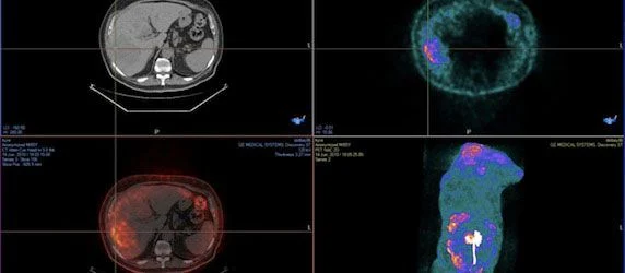 ECR 2014: Claron Presents CE Mark-Awarded NilRead Diagnostic Image Viewer