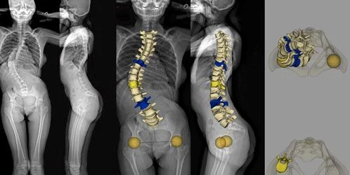 ECR 2014: EOS Imaging Partners with EuroSafe