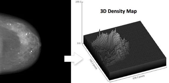 ECR 2014: Volumetric Breast Imaging Provides Data For Screening Dense Breasts