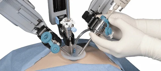 Frost &amp; Sullivan: Increasing Demand for Medical Robots in Surgical Disciplines