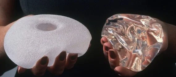 Breast Implant Register to be Introduced in England