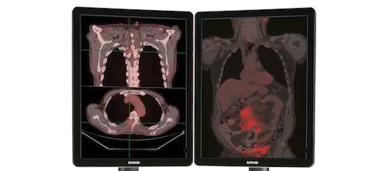 RSNA 2013: Barco Launches Nio Color 2MP LED Diagnostic Display 