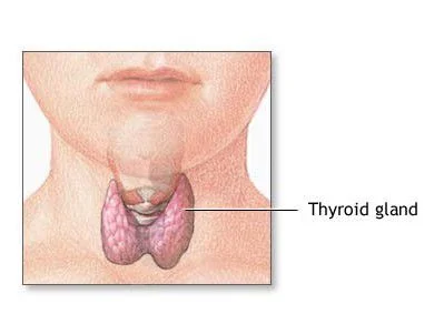 Zealous Imaging Leading to Unncessary Treatment for Low Risk Thyroid Cancer 