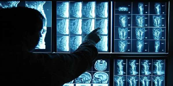 Is Early Imaging for Back Pain in Older Adults Necessary?