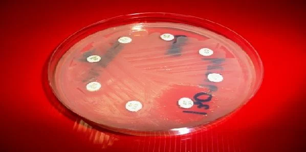 New Method Detects Antibiotic Resistance Fast