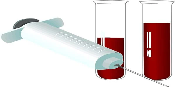 Single Blood Test To Screen For Different Types Of Cancer