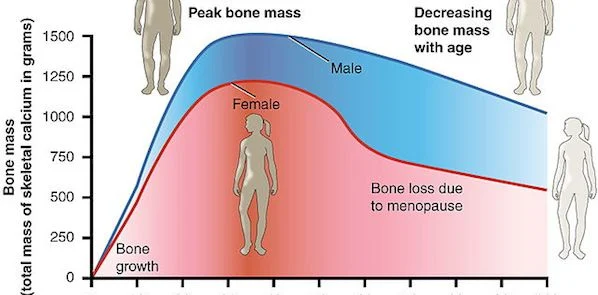 Bone Loss Drug Passes Trial; Side Effects Linger