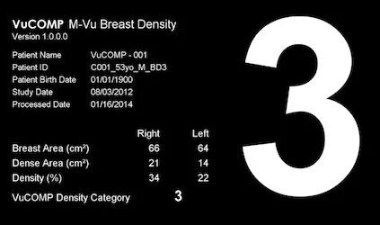 VuCOMP Computer-Aided Mammography Detection Installed at Baptist Health 