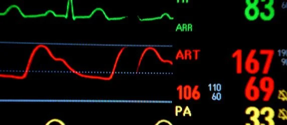 New Scan Identifies Heart Attack Risk