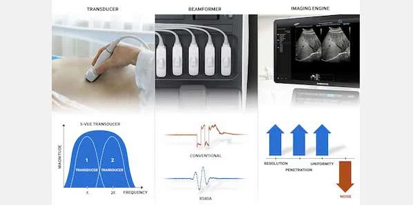 Samsung Introduces RS80A Premium Ultrasound System