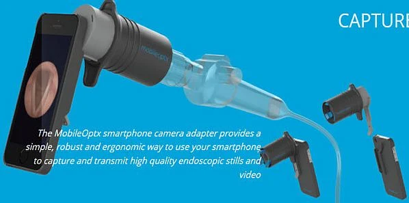Smartphone Camera Tool Captures Endoscopic Images